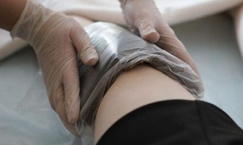 Tratamento de varices con compresas